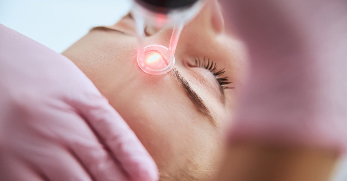 Read more about the article Laser Skin Rejuvenation