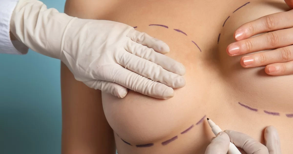 Read more about the article Tips to Reduce Swelling and Bruising Following Breast Lift Surgery