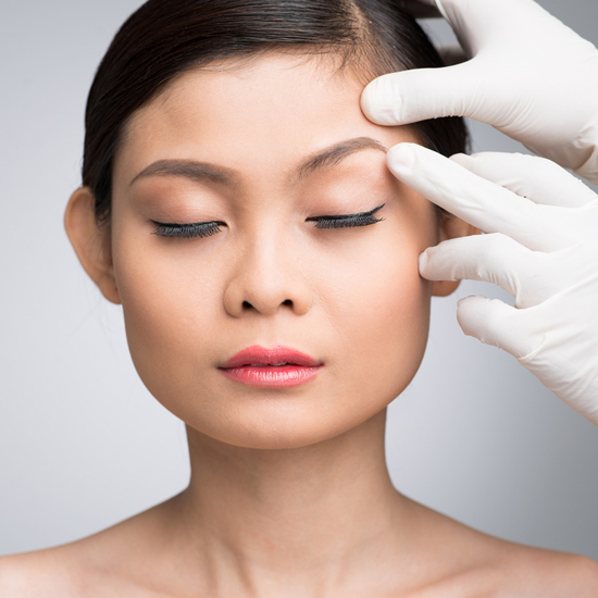 Brow Lift